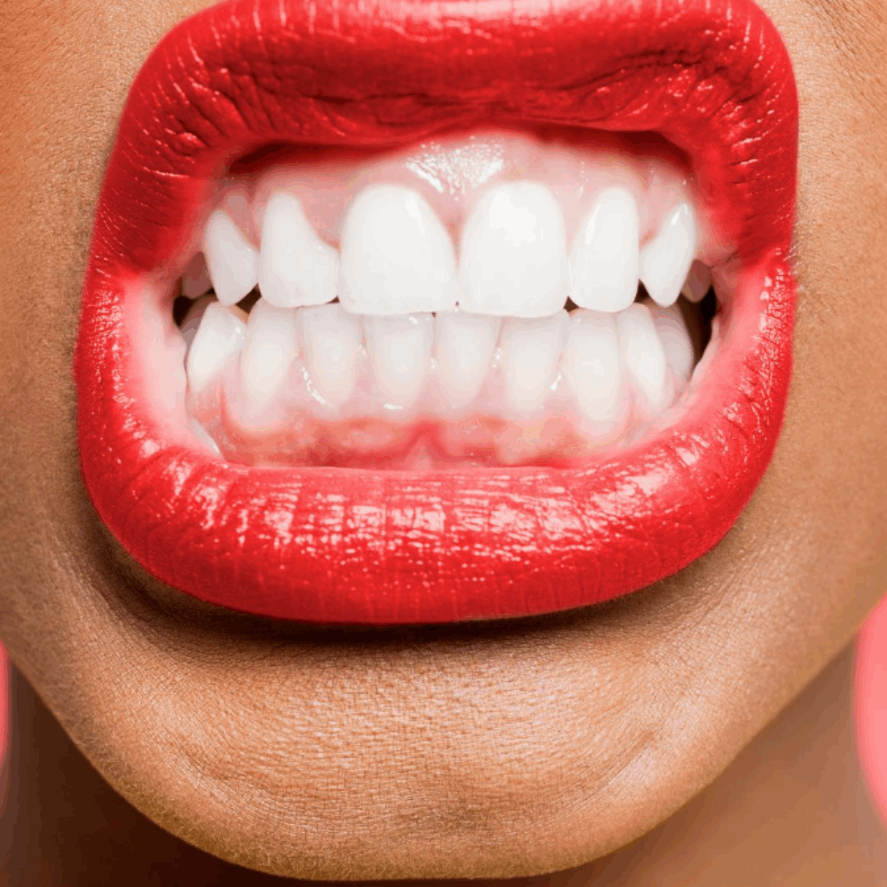 Botox and teeth grinding...what's the deal?