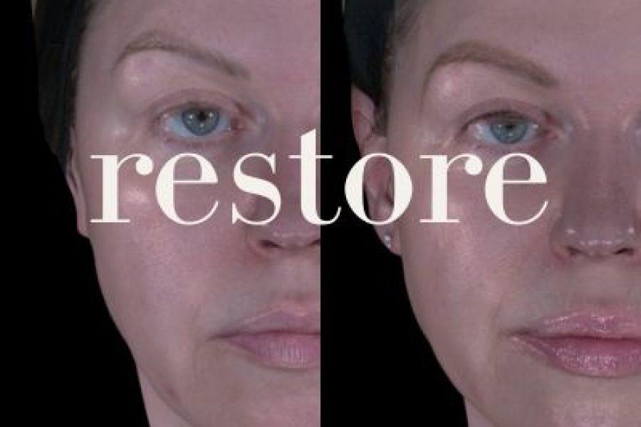 inject – restore