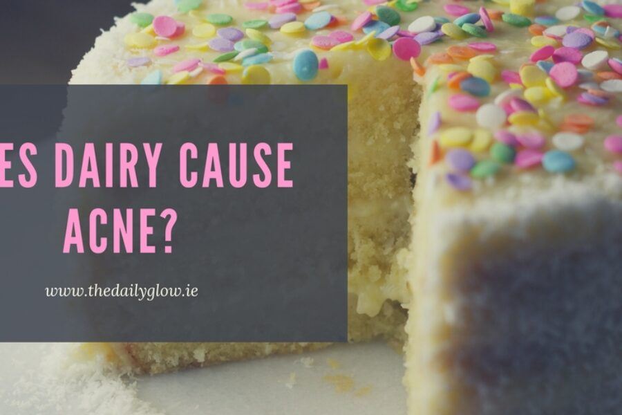 Does dairy cause acne?