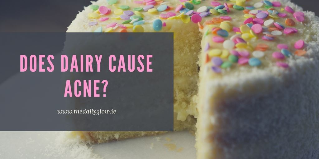 Does dairy cause acne?
